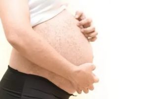 Корь при беременности
