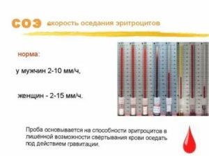 Высокое СОЭ и температура после операции