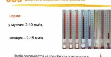 Высокое СОЭ и температура после операции