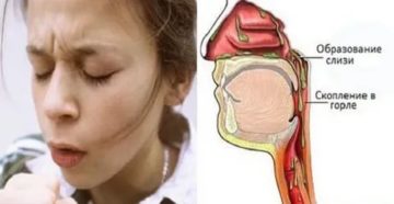Проблема с мокротой в горле Проблема с мокротой в горле