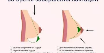 Почему нет формы груди