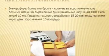Электрофорез с бромом на воротниковую зону при беременности