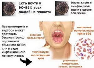 Вирус Эйнштейн барра и герпеса в слюне