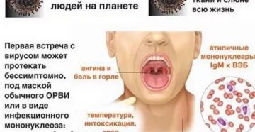 Вирус Эйнштейн барра и герпеса в слюне
