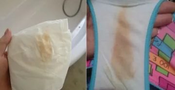 Боли в низу живота, розовые выделения, задержка