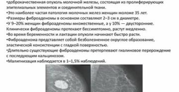 Фиброаденома и беременность. Онколог рекомендует удалить