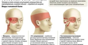Боль в глазу при остеохондрозе