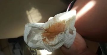 Коричневые выделения с неприятным запахом