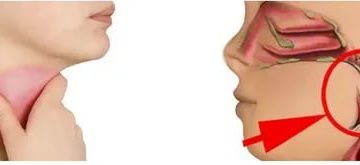 Слизь в горле, отхаркиваю, откашлявают, тяжело дышать, паника и истерика Слизь в горле, отхаркиваю, откашлявают, тяжело дышать, паника и истерика