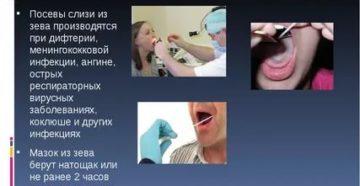 Посев из зева
