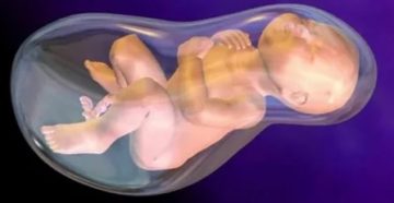 Маловодие на 19 неделе беременности