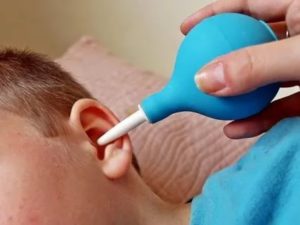 Промывание ушей малышу после рено-вакс