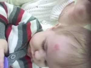 Малышке 2,5 месяца упала с дивана и ударилась головкой