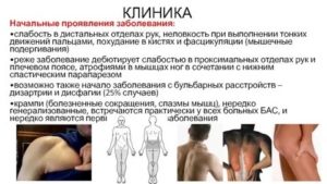 Фасцикуляции, мышечная слабость, тремор