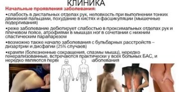 Фасцикуляции, мышечная слабость, тремор Фасцикуляции, мышечная слабость, тремор