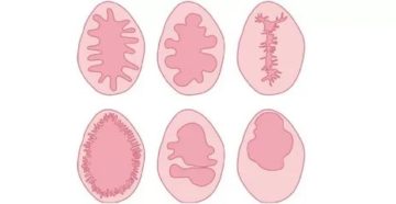 Повреждение девственной плевы при ласках