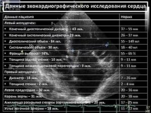 Рекомендации по результатам эхокардиограммы сердца