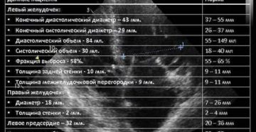 Рекомендации по результатам эхокардиограммы сердца