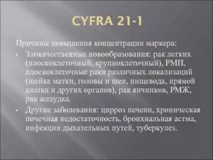 Почему повышен Cyfra21-1?