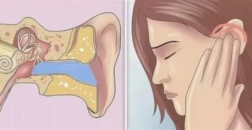 Закладывает уши после еды Закладывает уши после еды