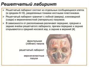 Мелкая киста клеток решетчатого лабиринта. Как лечится?