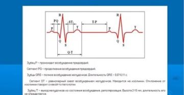 Есть ли проблемы с сердцем по результатам велоЭМ