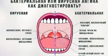 Болит горло и десна