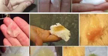 После поименения утрожестана утром вытекла липкая водичка