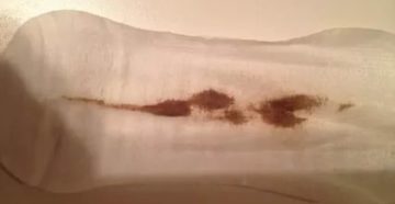 Кровянистые выделения при задержке