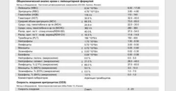 Повышены лимфоциты и тромбоциты