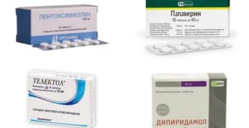 Лекарства при шейном остеохондрозе