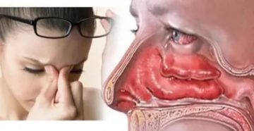 На протяжении шести лет заложен нос