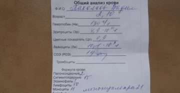 Мононуклеоз и анализ крови