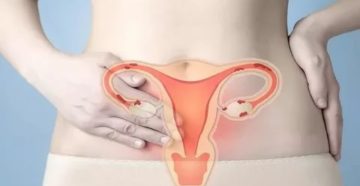 Болит яичник и низ живота после отмены ОК