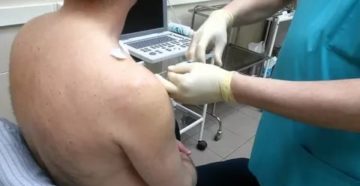 После блокады в плечевой сустав очень сильно болит плечо