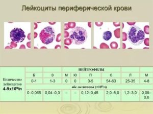 Лейкоциты в крови