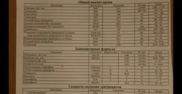 Плохие анализы крови у ребенка 8 лет после прививки от гриппа