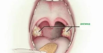 Что-то мешает в горле Что-то мешает в горле