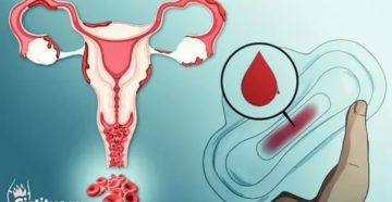 Может ли секс вызвать месячные?