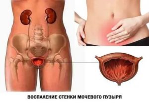 После родов ноющая боль внизу живота, после секса.