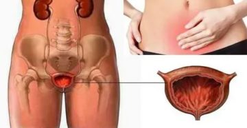 После родов ноющая боль внизу живота, после секса.