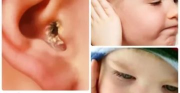 Не проходит отит 3 месяца Не проходит отит 3 месяца