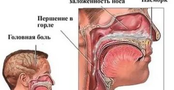 Постоянная заложенность носа, частые боли в горле