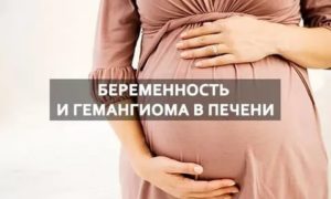 Беременность при гемангиомах в печени