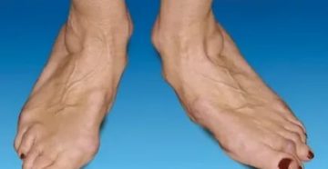 Пульсирует палец на ноге Пульсирует палец на ноге