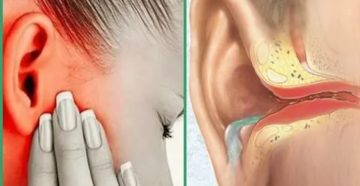 Дексаметозол при свисте в ухе Дексаметозол при свисте в ухе