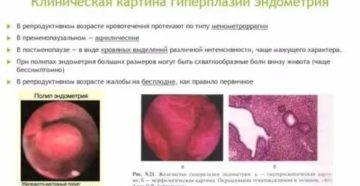 Гиперплазия полип кровотечение