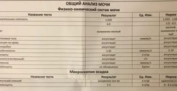 В анализе мочи лейкоциты повышены 25-30 В анализе мочи лейкоциты повышены 25-30