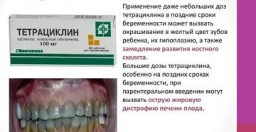 Прием тетрациклина во время беременности