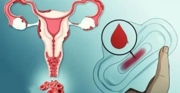 Кровянистые выделения после спринцевания